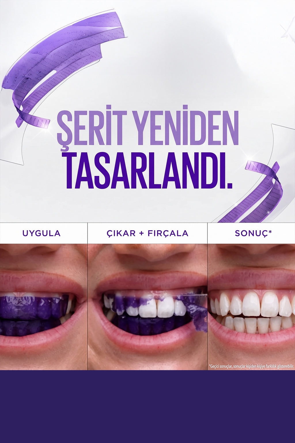 Mor Diş Beyazlatma Bantları - 7 Paket 14 Adet Bant