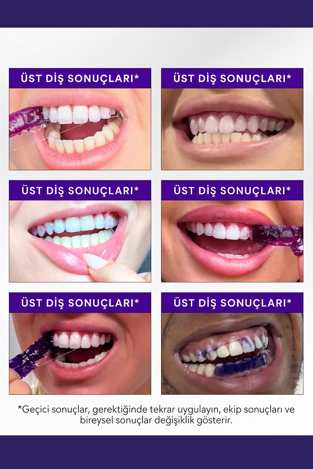 Mor Diş Beyazlatma Bantları - 7 Paket 14 Adet Bant